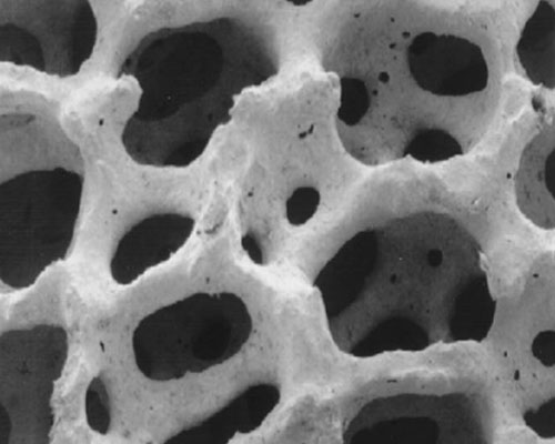 Porous Ceramic Foam Filter